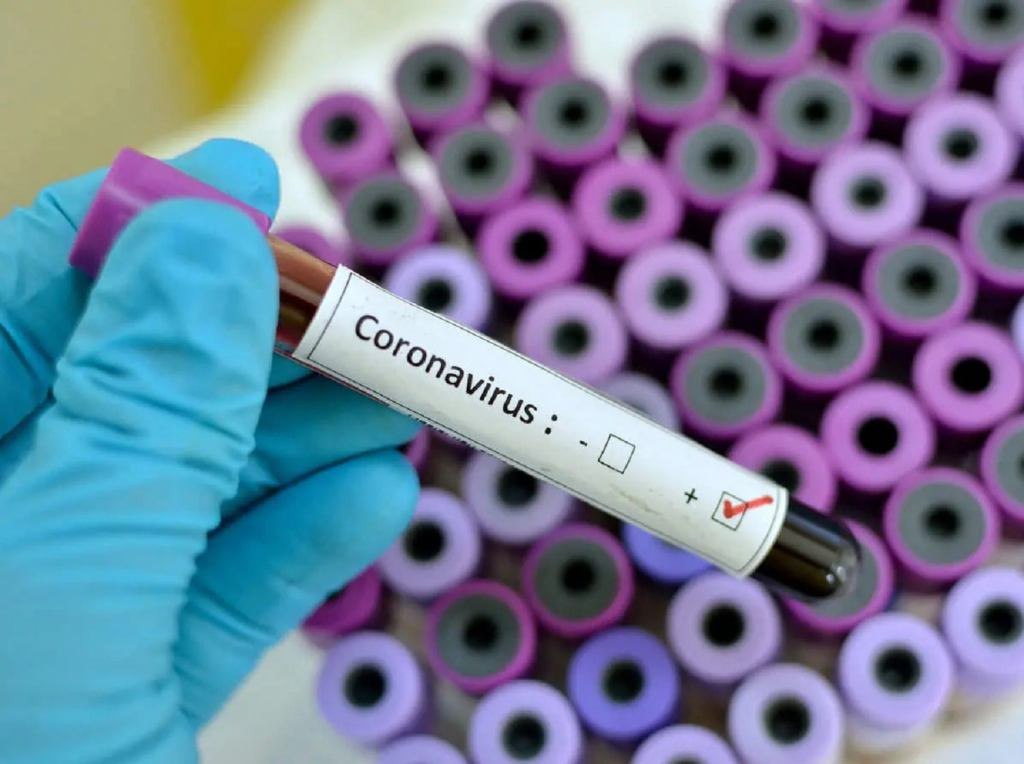 Rotimi Akeredolu Tests Positive For Coronavirus